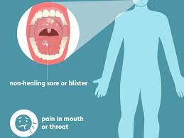 The most common early symptom of tongue cancer is a sore on your tongue. Oral Cancer Signs Symptoms And Complications