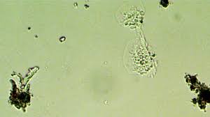 Unicellular amoeba motion under microscope 600x stock footage video 5696201 shutterstock. Amoeba Fission Youtube