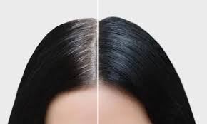 Gray Hair: How to Reverse Premature Graying?