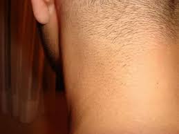 Find many great new & used options and get the best deals for advanced viss ipl hair removal system skin rejuvenation lamp at the best online prices at ebay! Review Viss Beauty Ipl Hair Removal System Unfinished Man