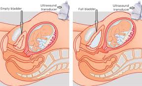 Ultrasound Scanning In Early Pregnancy And Fetal Abnormality Screening In Obese Women Sciencedirect