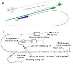 Concerning the reproductive outcomes, 46.2% (18/39) of the patients in the . A Flow Directed Balloon Catheter Cook That Was Used To Cannulate The Download Scientific Diagram