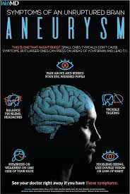 Brain aneurysms usually develop as people age, becoming more small aneurysms that haven't ruptured and aren't causing symptoms may not need treatment. Pin On Webmd Tips And Special Reports