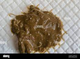 From feces hi-res stock photography and images - Alamy