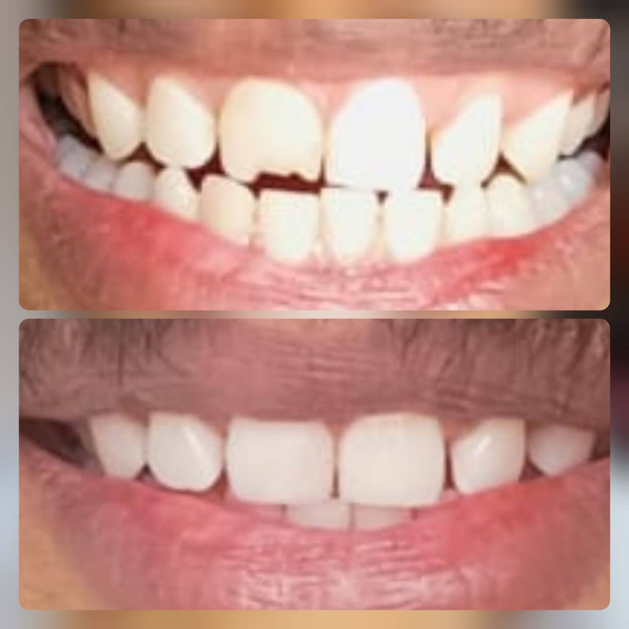 Esthetic dentistry product image