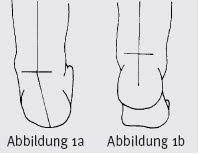 February 7 at 8:52 am ·. Knick Senk Oder Spreizfuss Vermeiden So Entwickeln Sich Die Fusse Ihres Kindes Gesund Elternwissen Com