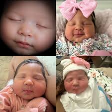 March 3D/HD Pictures — First Glimpse Prenatal Imaging