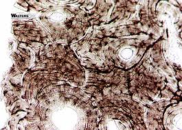 Microscopic osteology and bone formation. Compact Bone Microscopic View Diagram Quizlet