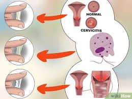 If you have more than average, consider wearing a woo hooo, vaginal discharge rhythm master over here, and my 5th grade math teacher said i wouldn't amount to anything. How To Diagnose Vaginal Discharge 13 Steps With Pictures