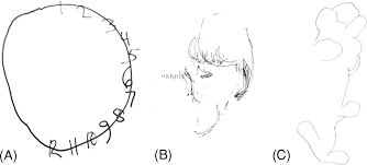• the examiner indicates the appropriate space and gives the following instructions: Neurobehavioral And Neuropsychiatric Assessment Section Ii Behavioral Neurology Neuropsychiatry