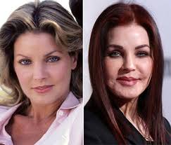 50 Extreme Celebrity Plastic Surgery Photos You Won T Believe Celebrity Plastic Surgery Bad Plastic Surgeries Priscilla Presley Plastic Surgery