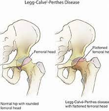 What Is Legg Calve Perthes In Dogs Top Lap Dogs