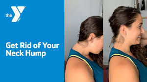 Yoga also does wonders for the neck. Get Rid Of Your Neck Hump Youtube