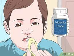 3 Formas De Eliminar A Candidiasis Bucal En Bebes