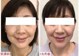櫻井亜希子 顔のシワたるみは運動不足 シワ たるみ 美容整形 スキンケア