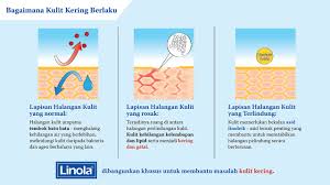 Madu dipercaya dapat mengatasi masalah kulit kering wajah nih moms. Rupanya Bila Kulit Jadi Kering Kasar Berkedut Inilah Sebabnya Mingguan Wanita