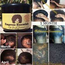 This is the best hair loss lotion from biotique which is known for its natural products. 11 Best Hair Growth Cream Ideas Hair Growth Cream Hair Growth Hair Growth Treatment