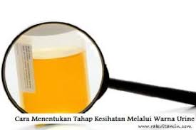 Warna air kencing bisa kamu jadikan indikator kesehatan, lho. Tahap Kesihatan Melalui Warna Urine Rakvitamin Com