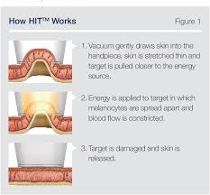 It leaves the skin looking smoother and silkier than waxing, electrolysis or razors and is a gentle technique that can treat larger areas effectively with minimal discomfort and. Pdf Optimizing The Efficacy And Comfort Of Laser Hair Removal Treatment Semantic Scholar