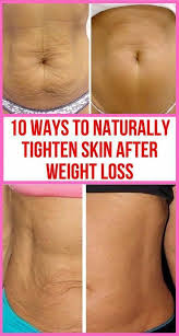 Pin On Saggy Skin On Lower Stomach