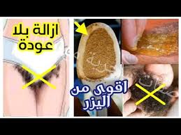 ازالة الشعر معلقة صدمتنى لما جربتها لازالة شعر العانة والجسم كلة نهائيا سيسقط ولن ينمو مجددا Youtube In 2020 Beauty Youtube Dina