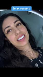 Zirconia Teeth Solutions at Hourani Dental Clinic