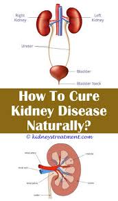 Kidney Disease Cases In 2020 Chronic Kidney Disease Diet Kidney Kidney Disease