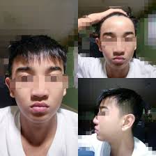 The message from this research seems clear: I Need A New Haircut For My Stubborn Asian Hair And Big Forehead More Details In The Comments Malehairadvice