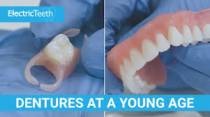 No hidden fees or costs with clearchoice®. Dentures At A Young Age Youtube