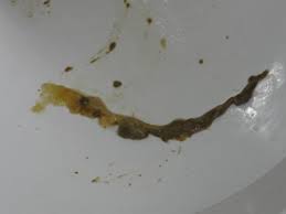 Die körperlichen befunde sind typischerweise unauffällig, im stuhl lässt sich kein blut nachweisen. Darm Parasiten Symptome Und Behandlung Heilwege Fur Mensch Tier Parasiten Des Menschen