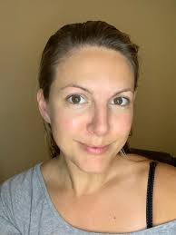 Peachy Skin Clinic Amlwch 🥰