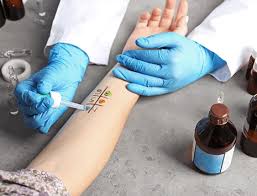 Image result for Allergy Screening