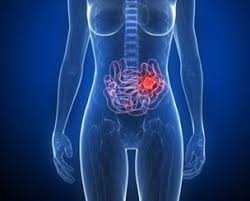 Mal au ventre, envie de vomir. Mon Epouse A Ete Emportee En 24 Heures Docteurclic Com