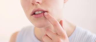 Herpes Symptome Ubertragung Behandlung