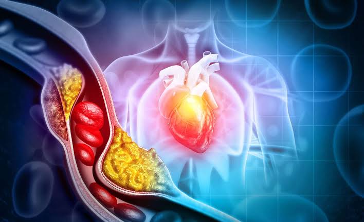 Oxidized LDL (OxLDL): The Risk Factor You Need to Know