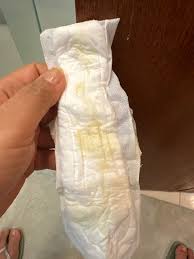 Corrimento esverdeado sem cheiro e coceira | BabyCenter