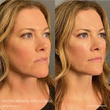 Holly Tabor, MS, APRN, FNP-C