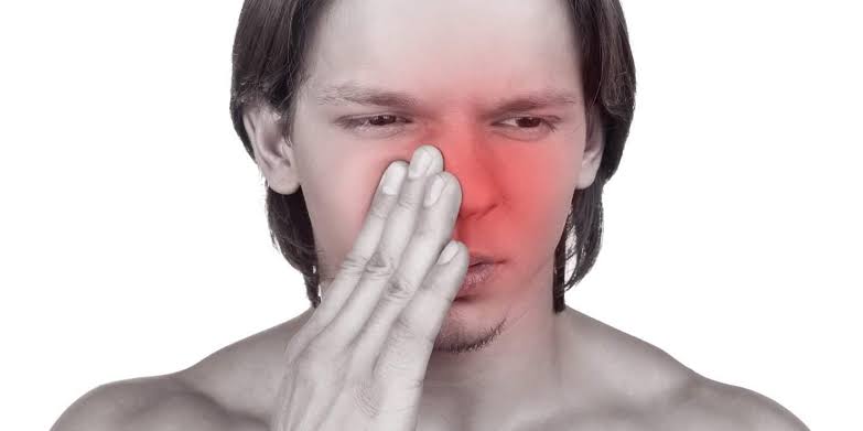 Ung thư mũi xoang là gì? Triệu chứng, nguyên nhân và điều trị