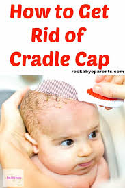 Cradle cap usually doesn't require medical treatment, as it usually goes away on its own. How To Get Rid Of Cradle Cap 6 Different Treatments To Try