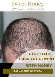 Finasteride restrains an enzyme that converts testosterone to dht, the hormone that causes hair loss in men, and unlike minoxidil, this drug can actually help hair grow back as well as prevent. Best Hair Loss Treatment With Honey Sweet Honey