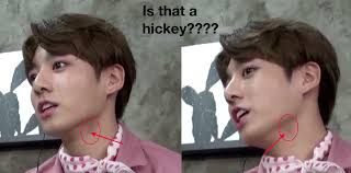 Probably A Pimple Covered Badly With Makeup Xd But If It Was Jin Would Beat Him Kpop Memes Kdrama Memes Bts Memes