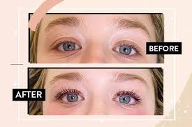 It happens that over time they become smaller, they become thinner. 5 Proven Methods To Get Longer Eyelashes From A Derm