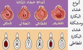 اسرار ليلة الدخلة posts facebook