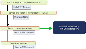 The cervical cancer therapies available to you may include advanced surgical and radiation therapy techniques; Brief History Of Surgical Treatment For Cervical Cancer Springerlink