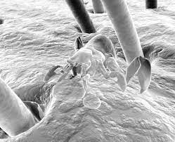 How To Make A Mixture To Get Rid Of Mites In Human Hair Demodex Demodex Mites Demodex Treatment