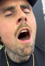 Comedian Talks about Pig Feet