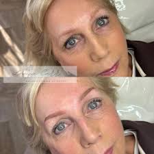🤎 POWDER BROW 🤎 Andrea came to me to have a new lease of life into her  brows 🪄 Andrea already had some old pigment (red) in her brow area which  has