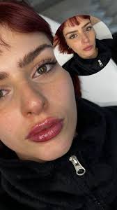 Embellecimiento de labios ‼️🔥🔥, Tratamiento personalizado, y en armonía  con tu rostro 🙌🏼