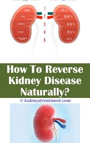What Are Kidney Stones Kidney Disease Symptoms Kidney Disease Recipes Kidney Disease Diet
