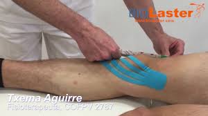 Tecnica Linfatica Para La Rodilla Mediante Vendaje Neuromuscular Youtube